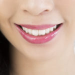 ビューティホワイトニング白い歯
